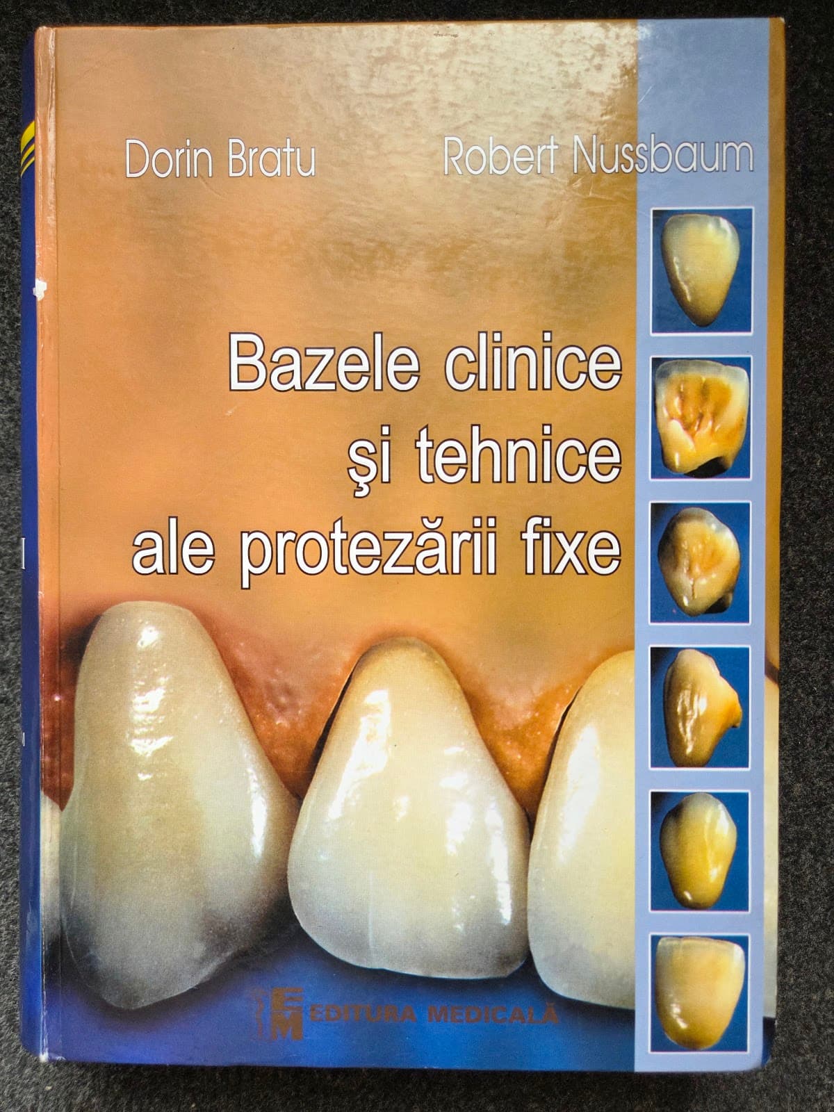 BAZELE CLINICE SI TEHNICE ALE PROTEZARII FIXE